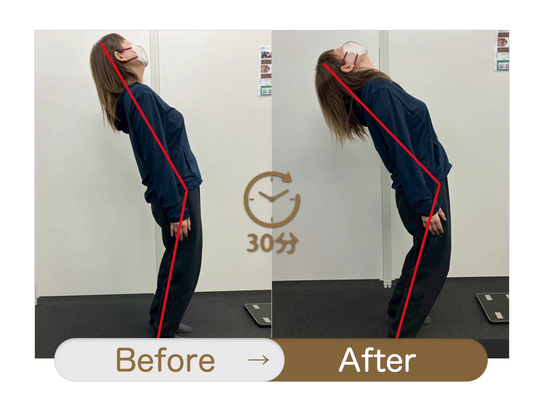もみほぐし【肩こり/腰痛改善】リラクボディのビフォーアフター