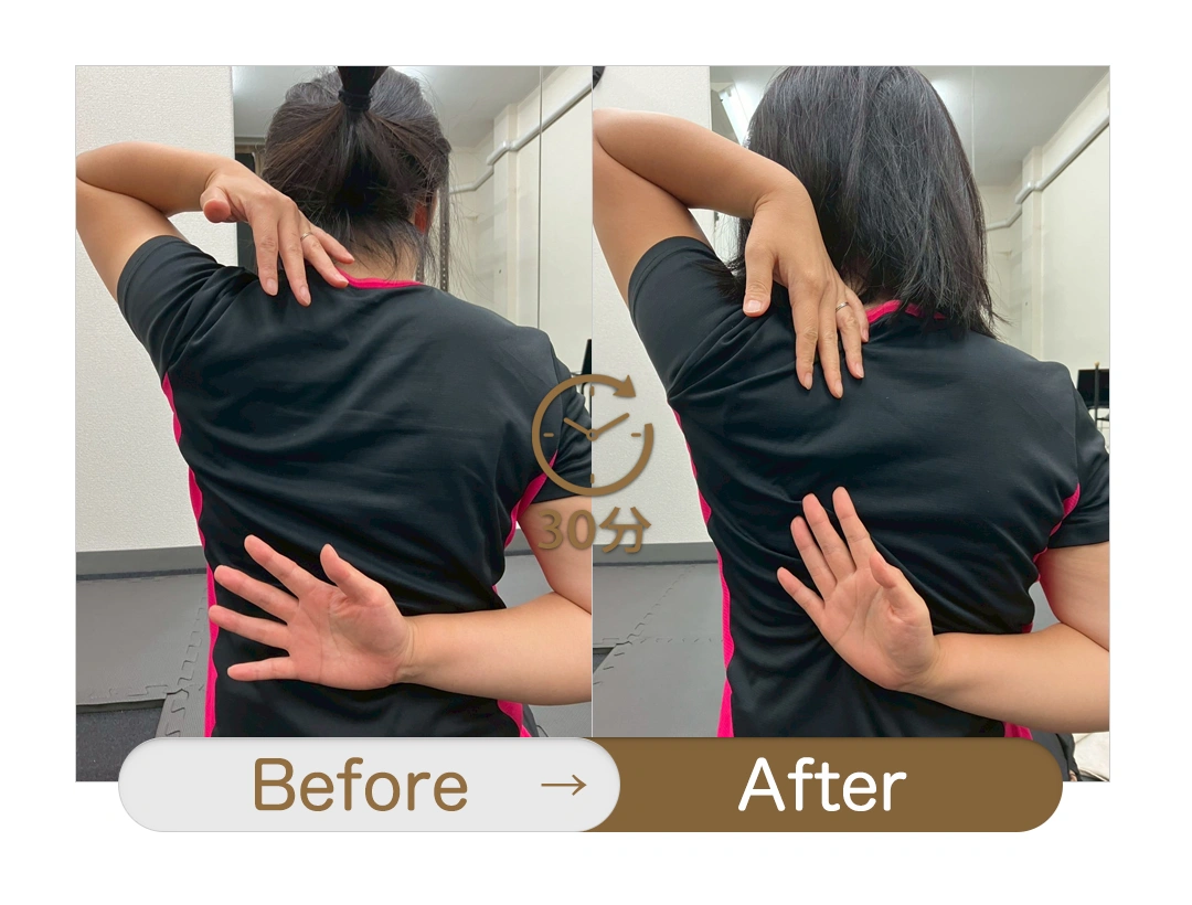 もみほぐし【肩こり/腰痛改善】リラクボディのビフォーアフター