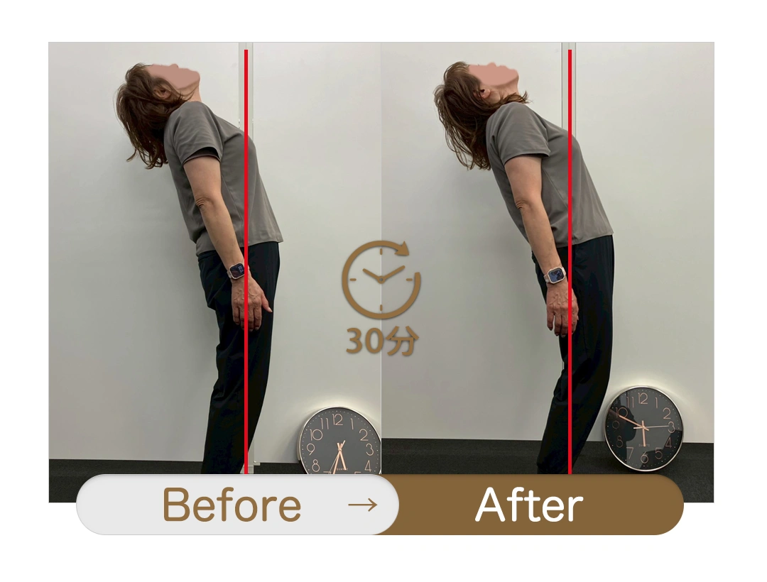 もみほぐし【肩こり／腰痛改善】リラクボディのビフォーアフター