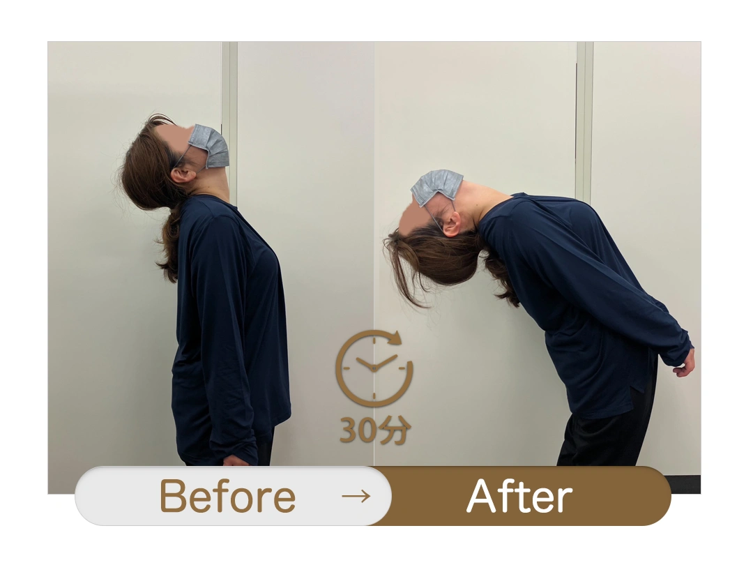 もみほぐし【肩こり／腰痛改善】リラクボディのビフォーアフター