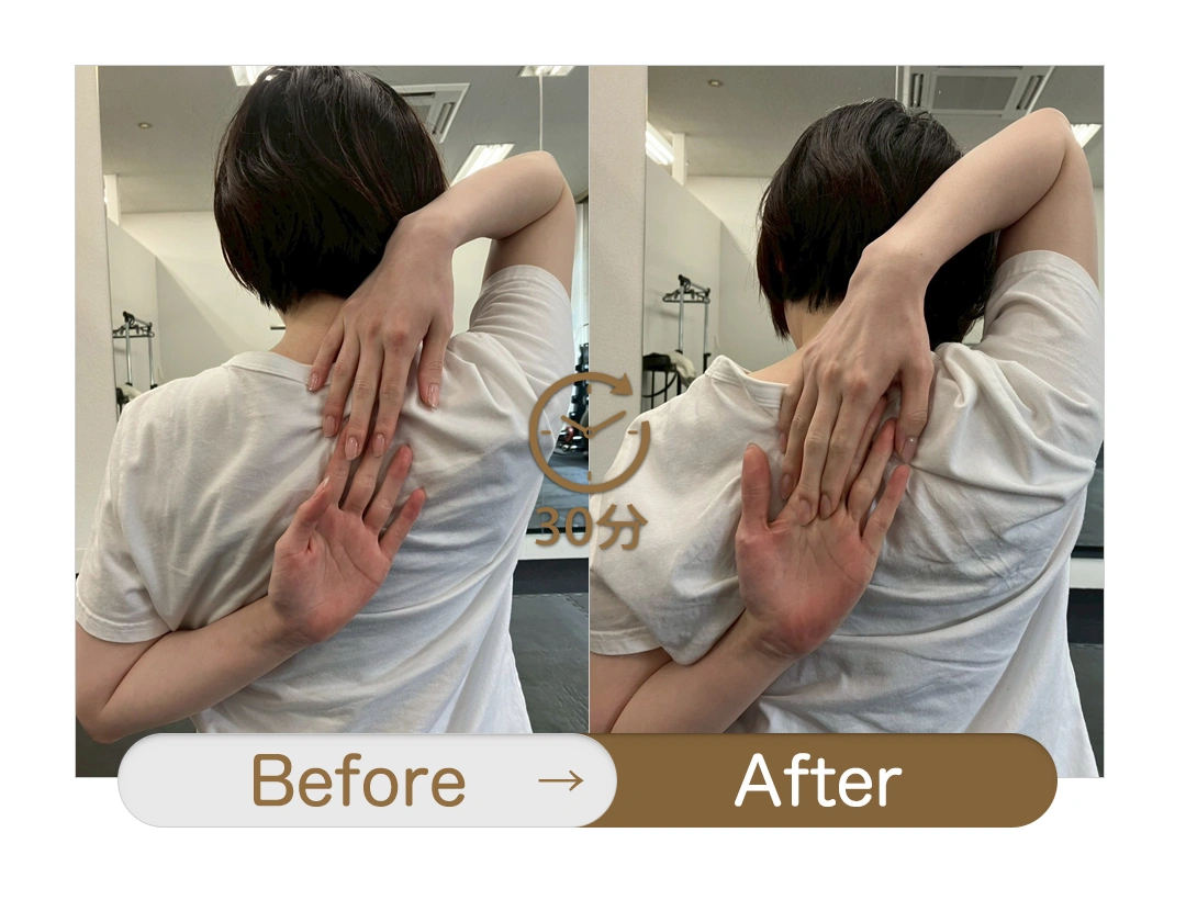 もみほぐし【肩こり／腰痛改善】リラクボディのビフォーアフター