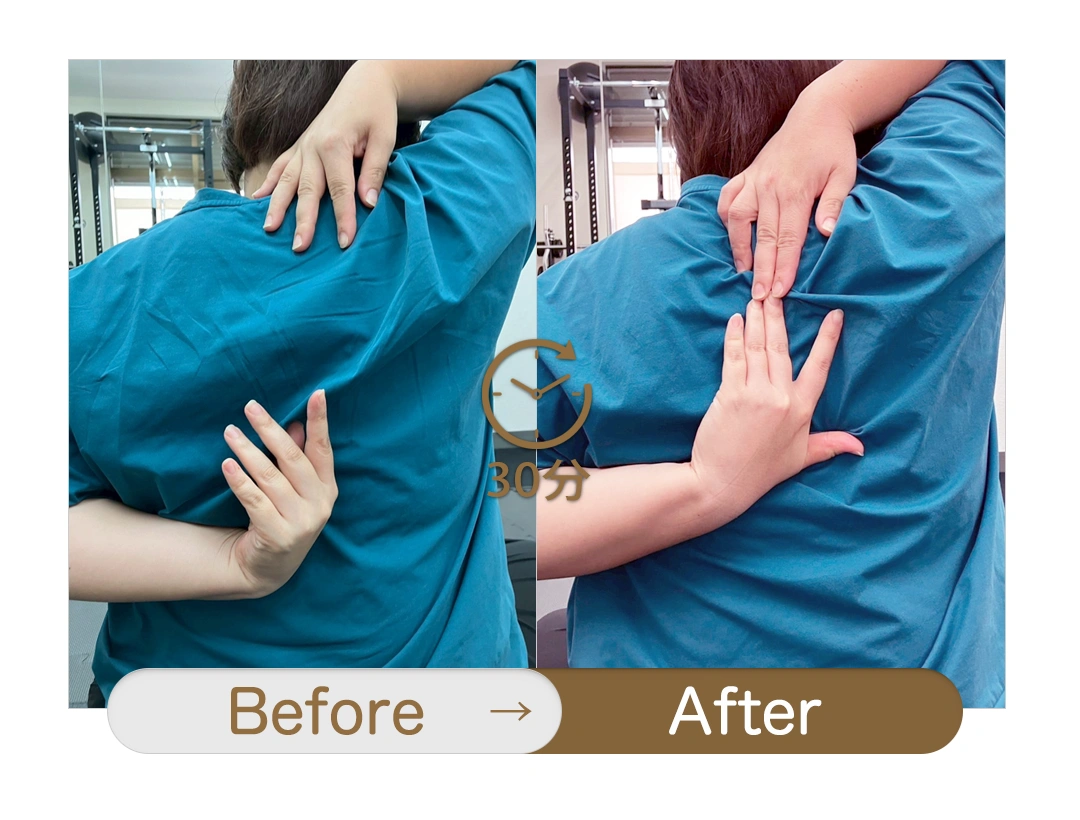 もみほぐし【肩こり／腰痛改善】リラクボディのビフォーアフター