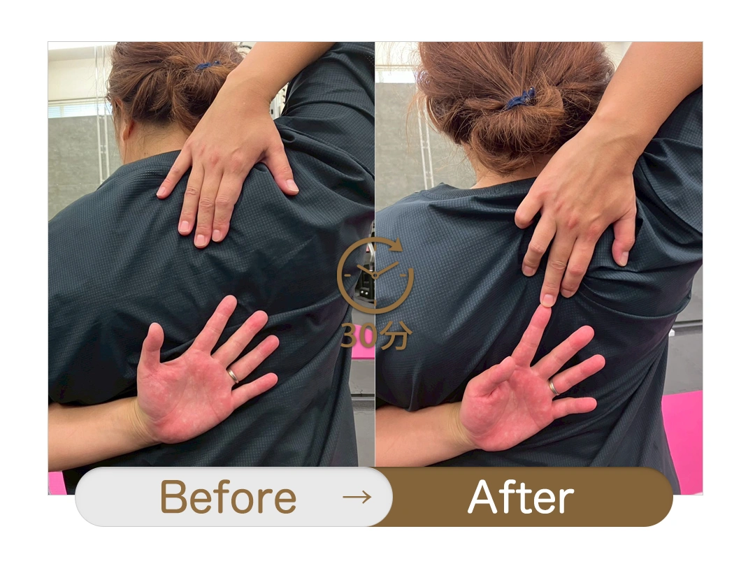 もみほぐし【肩こり／腰痛改善】リラクボディのビフォーアフター