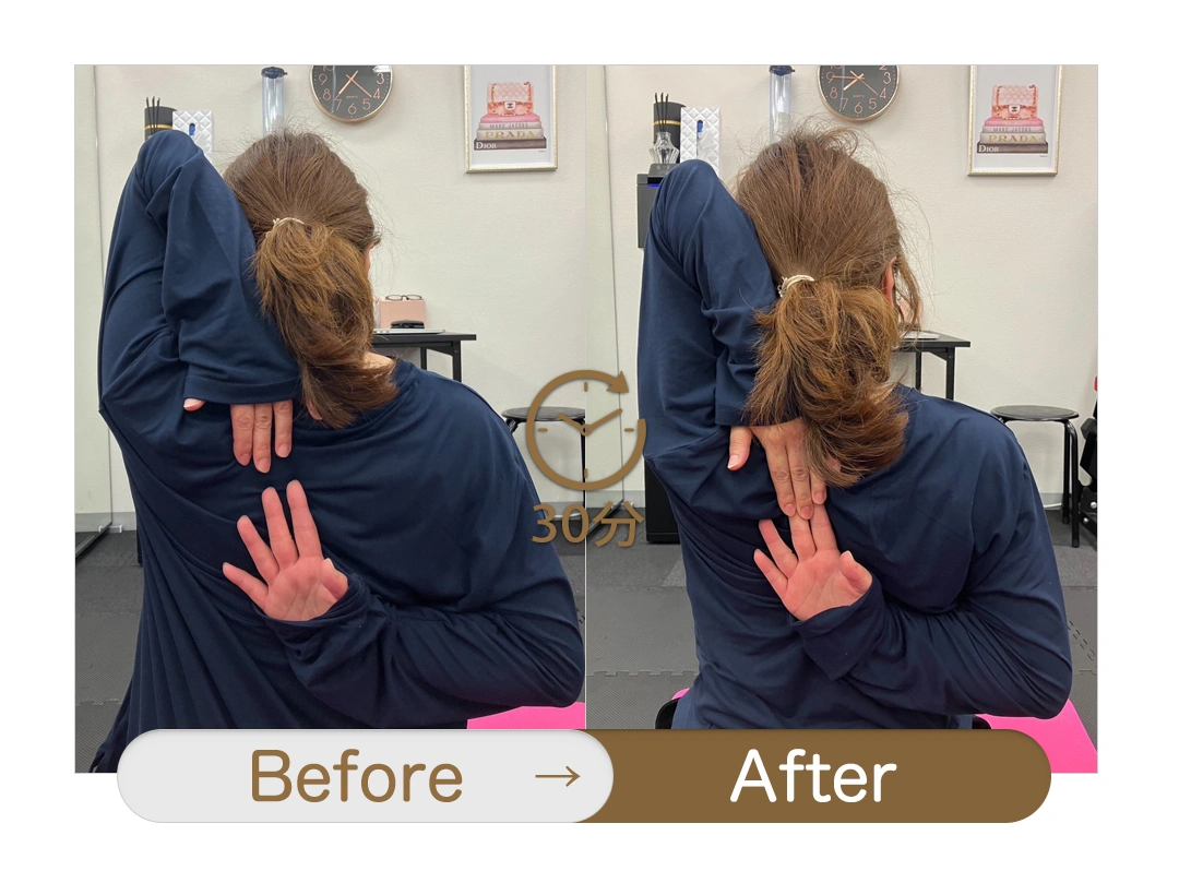 もみほぐし【肩こり／腰痛改善】リラクボディのビフォーアフター